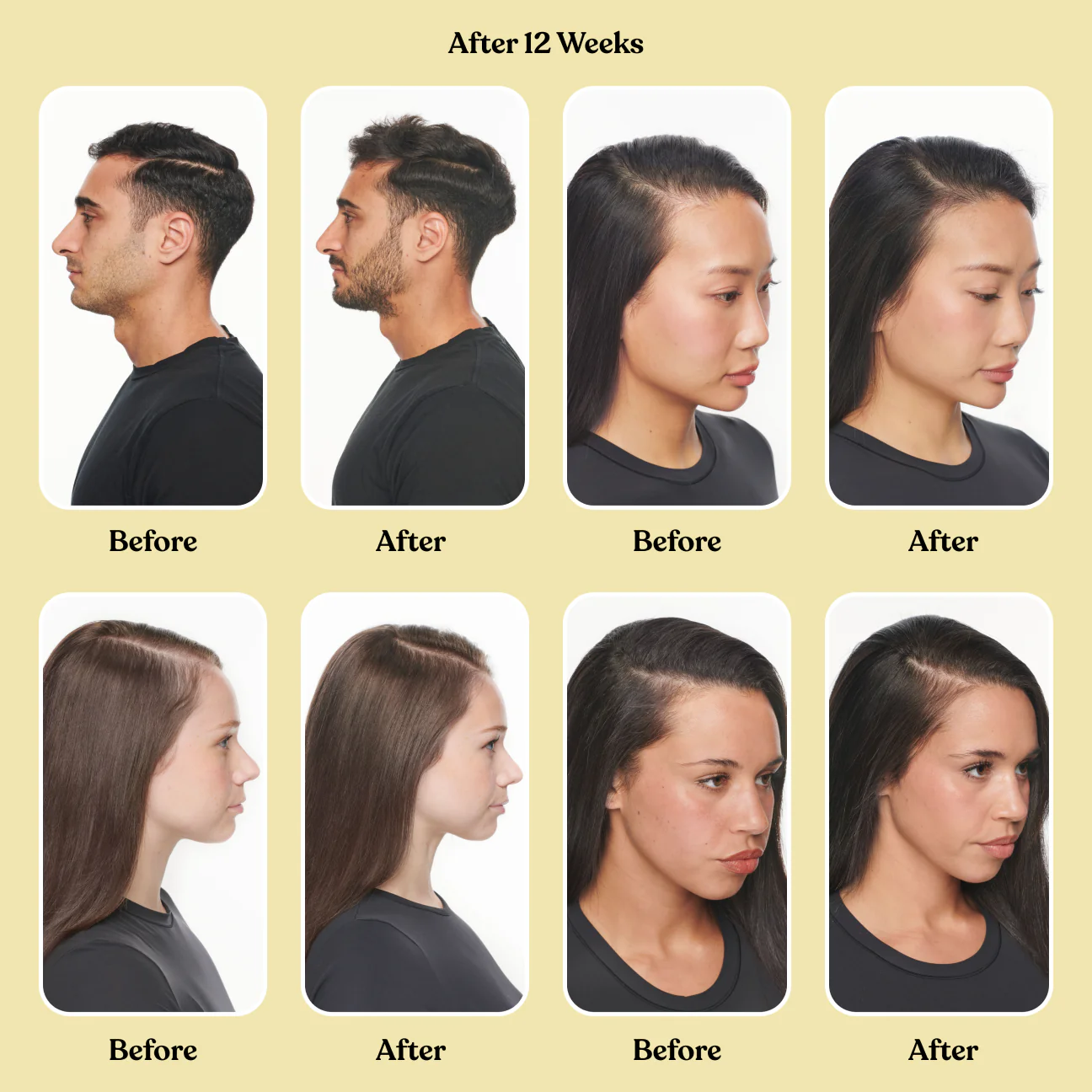 LEMME GROW CAPSULES
Hair Growth & Anti-Shedding (Biotin-Free)