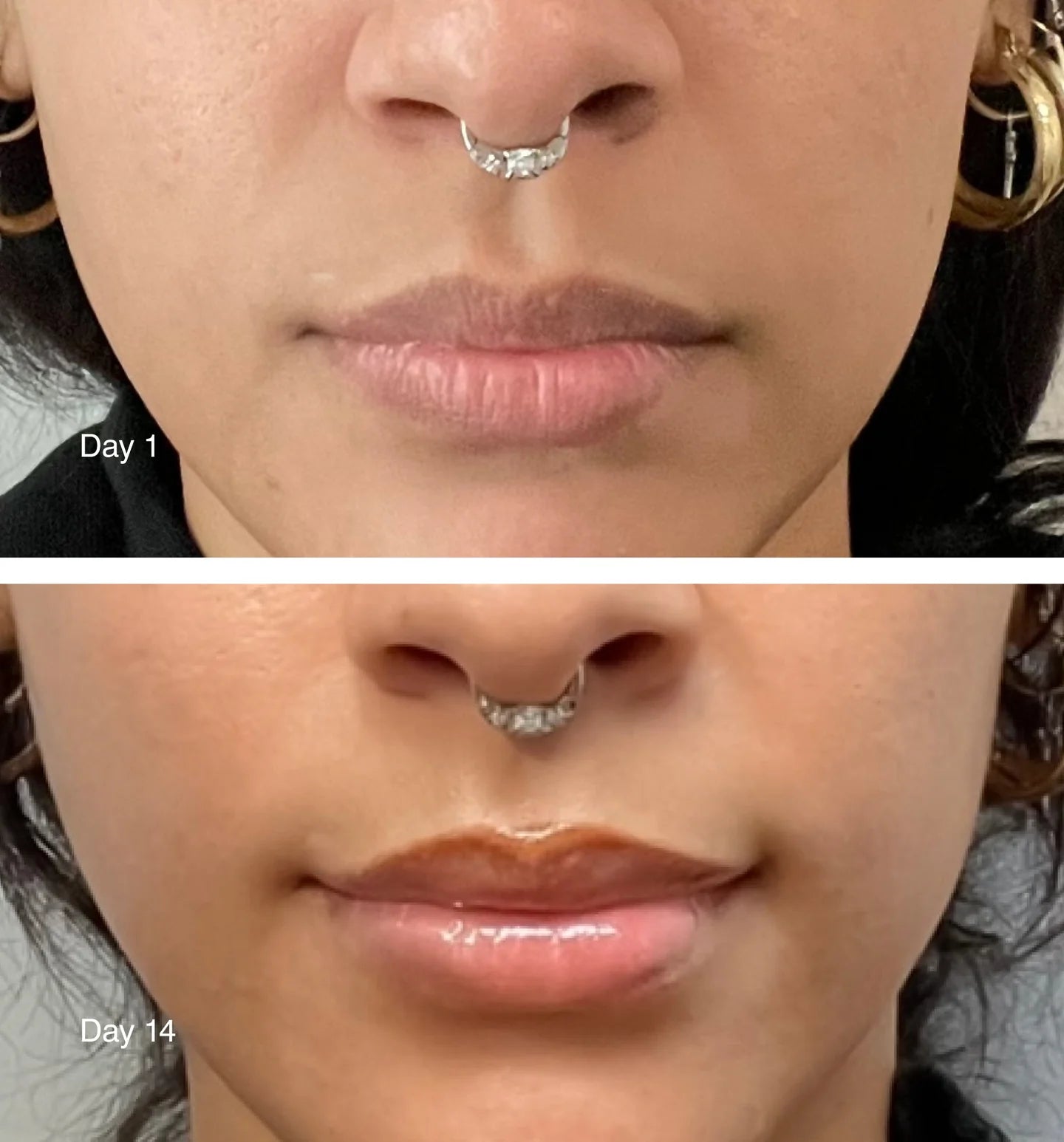 Peptide lip treatment