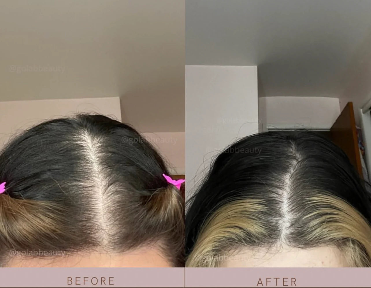 GÔ LAB STRENGTHENING SCALP MASSAGE OIL