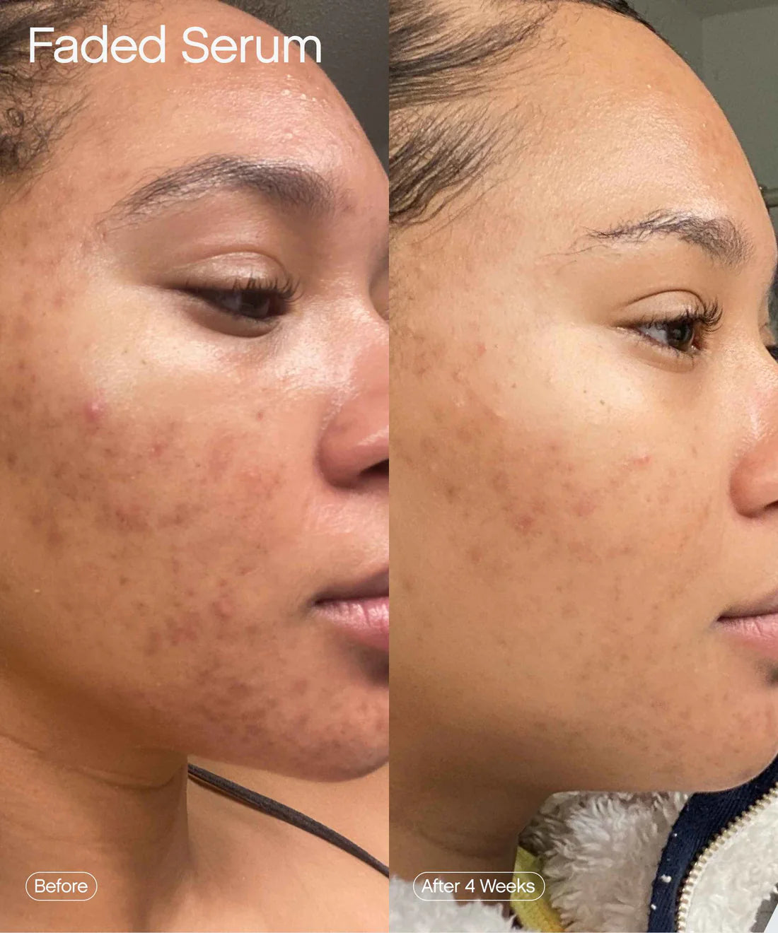 Topicals Faded Serum
For Dark Spots & Discoloration