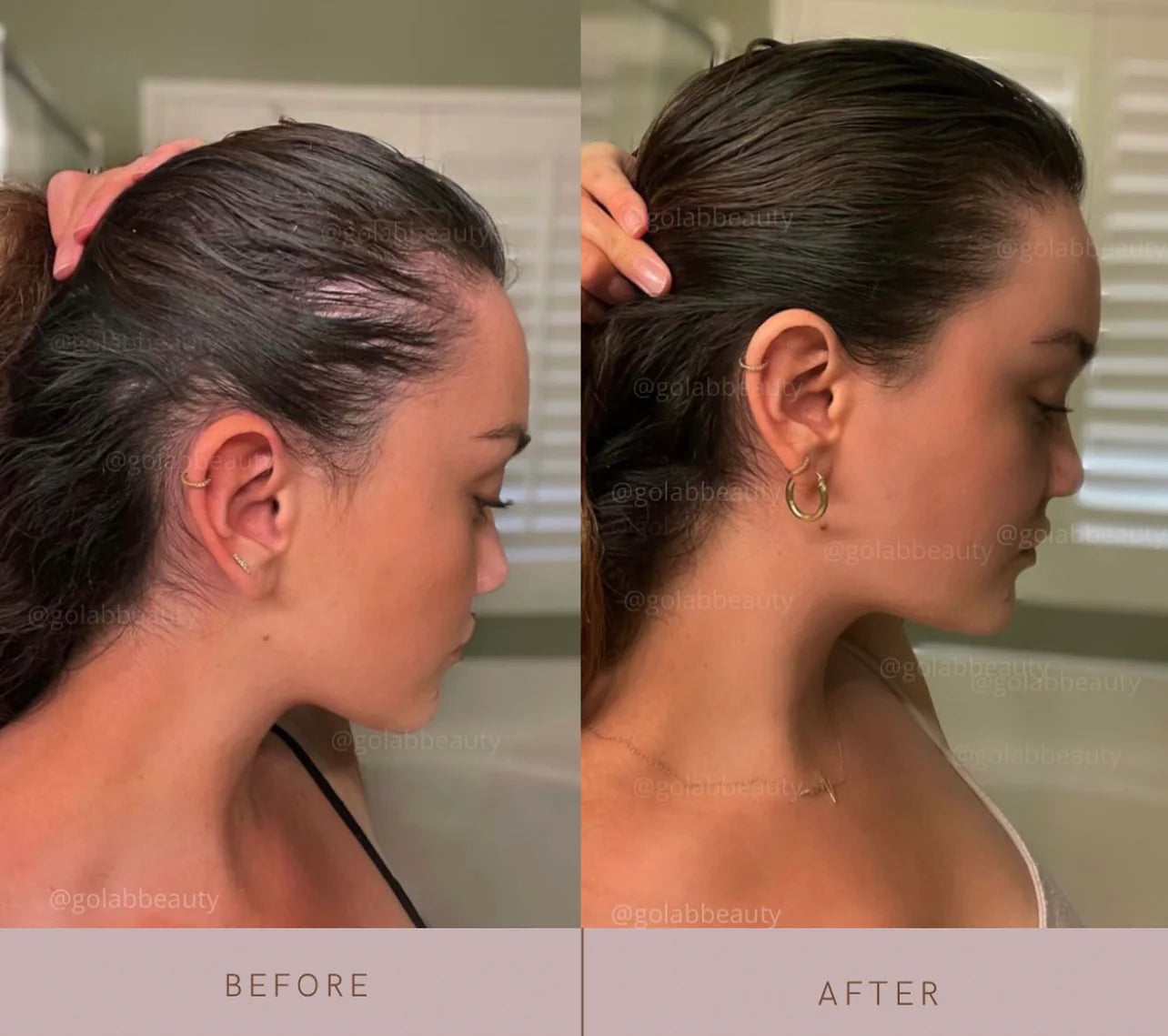 GÔ LAB STRENGTHENING SCALP MASSAGE OIL