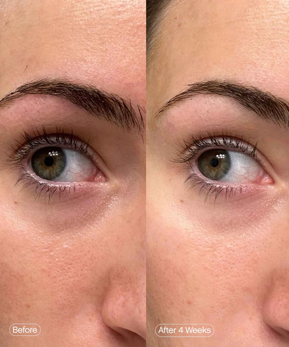 Topicals Faded Under Eye Masks
Brightening Eye Masks
