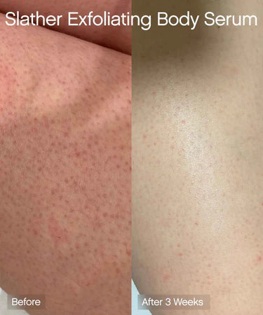 Topicals Slather Exfoliating Body Serum
With Retinol and AHAs
150 ml / 5 fl oz